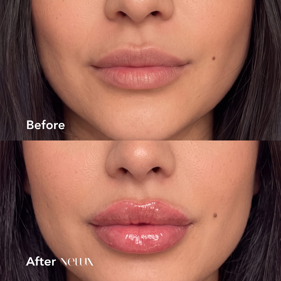 Maximum Instant Filler Lip Plumper